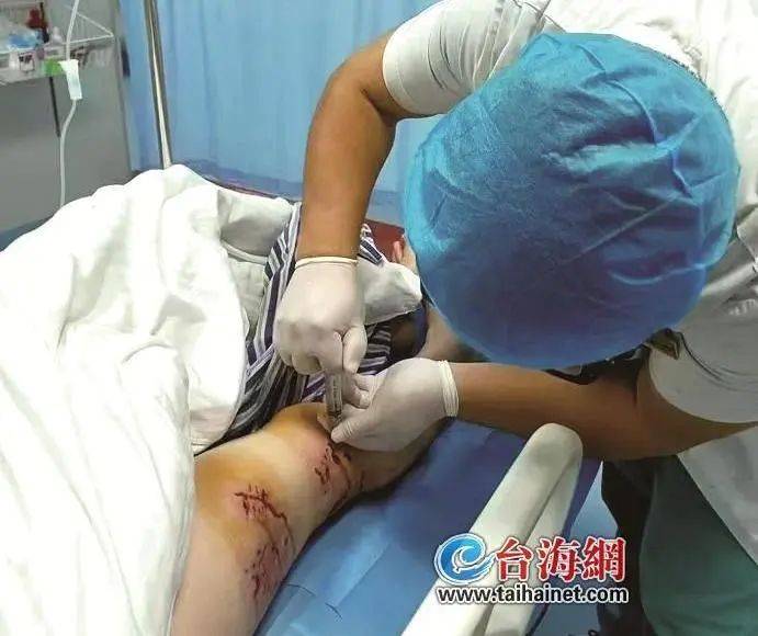 手臂肌腱被咬断！近期激增，半个月接诊近200例……