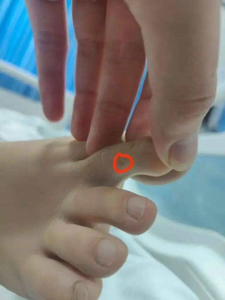紧急转院仍无力回天！三亚蛇咬事件暴露旅游安全漏洞