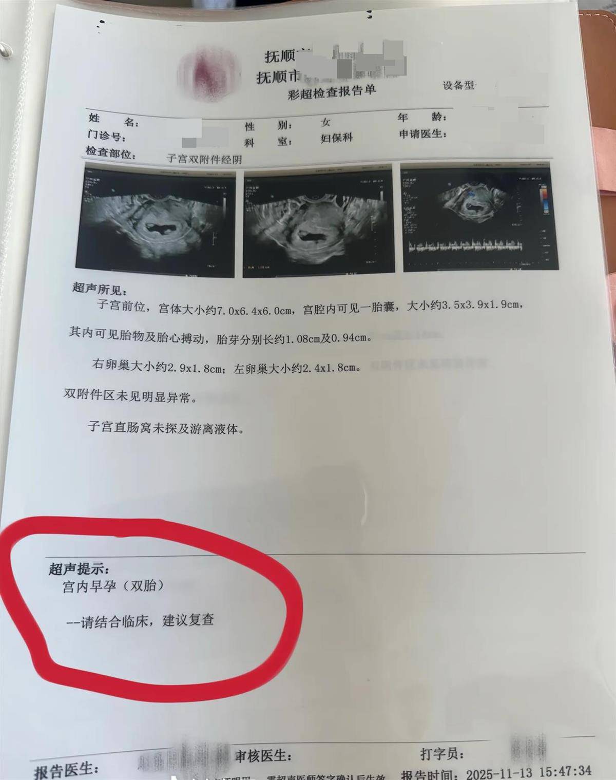 辽宁一孕妇两个月内从一胎变四胞胎，每次产检发现多出一胎，医生：系同卵四胞胎，概率1300万至1500万分之一